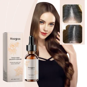 HOEGOA Hair Growth & Scalp Treatment Oil – 30ml